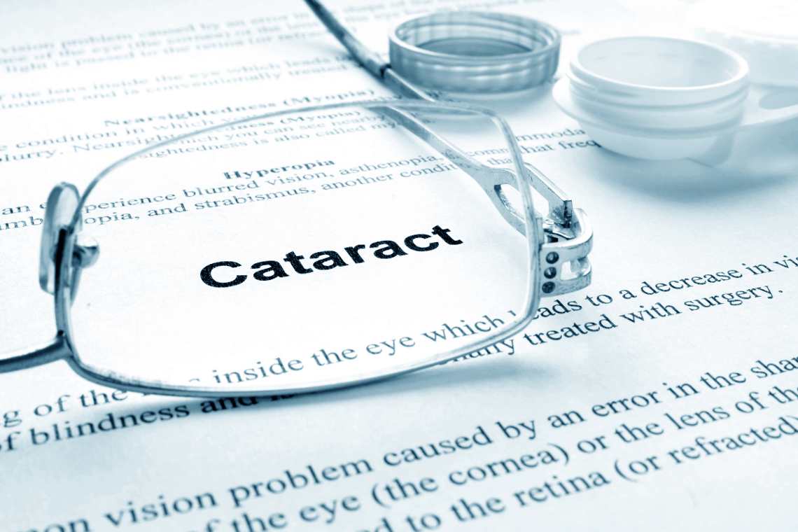 cataract definition.