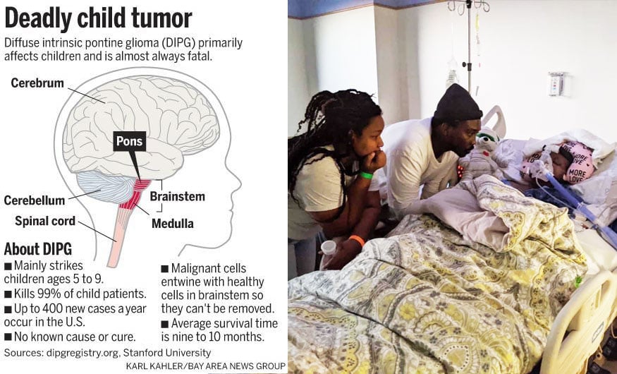 DIPG Brain Cancer Infographic With Mikeal In Hospital