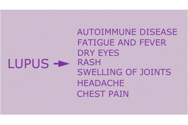 lupus symptoms